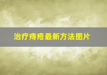 治疗痔疮最新方法图片