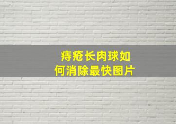 痔疮长肉球如何消除最快图片